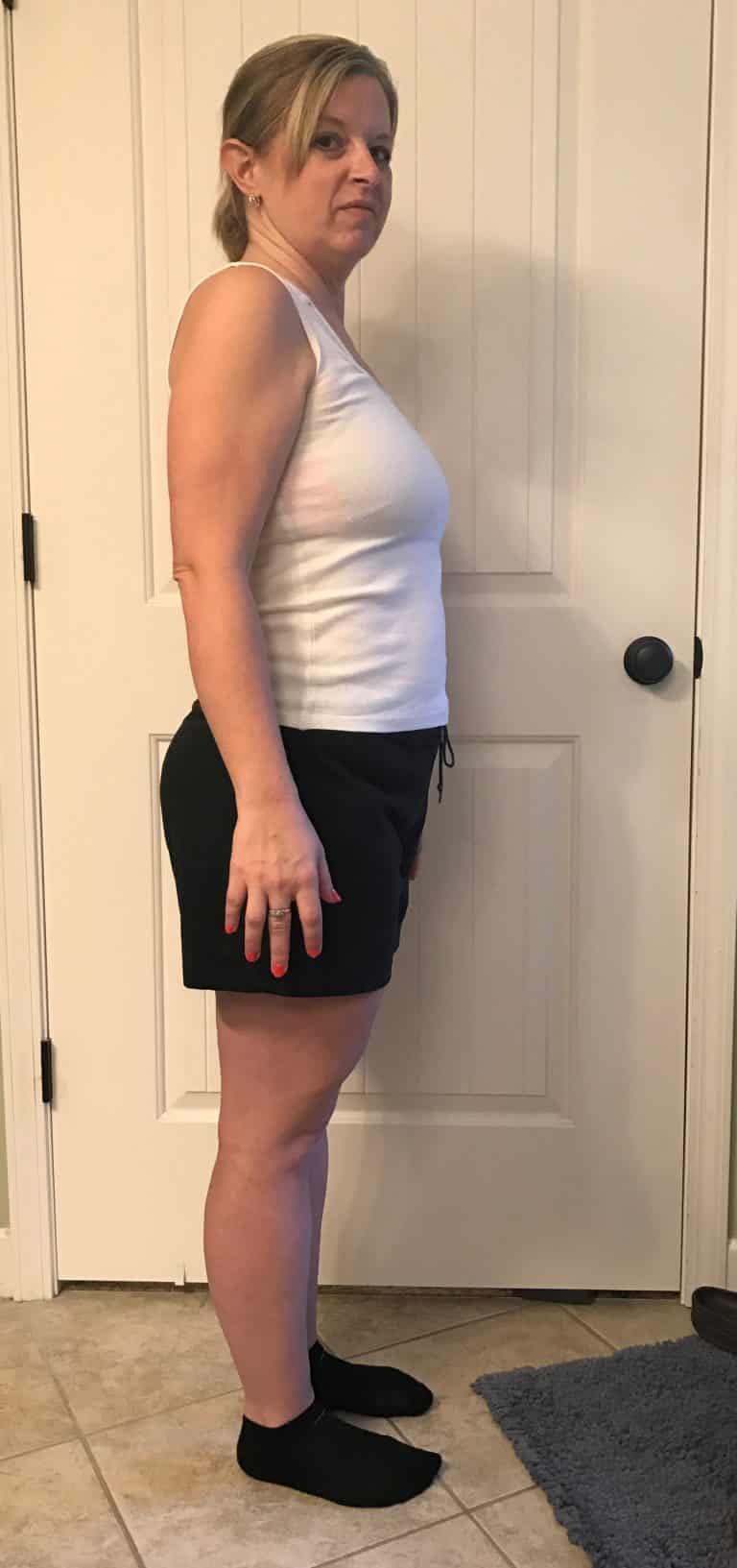 Medically Supervised Weight Loss • Bluegrass Medical Aesthetics